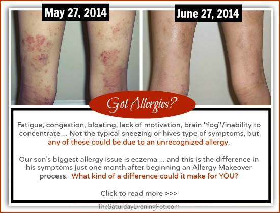 Allergy Makeover Update Amazing Results